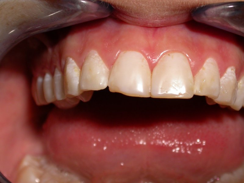 DSCN1511 - Image at Frenchs Forest Dental